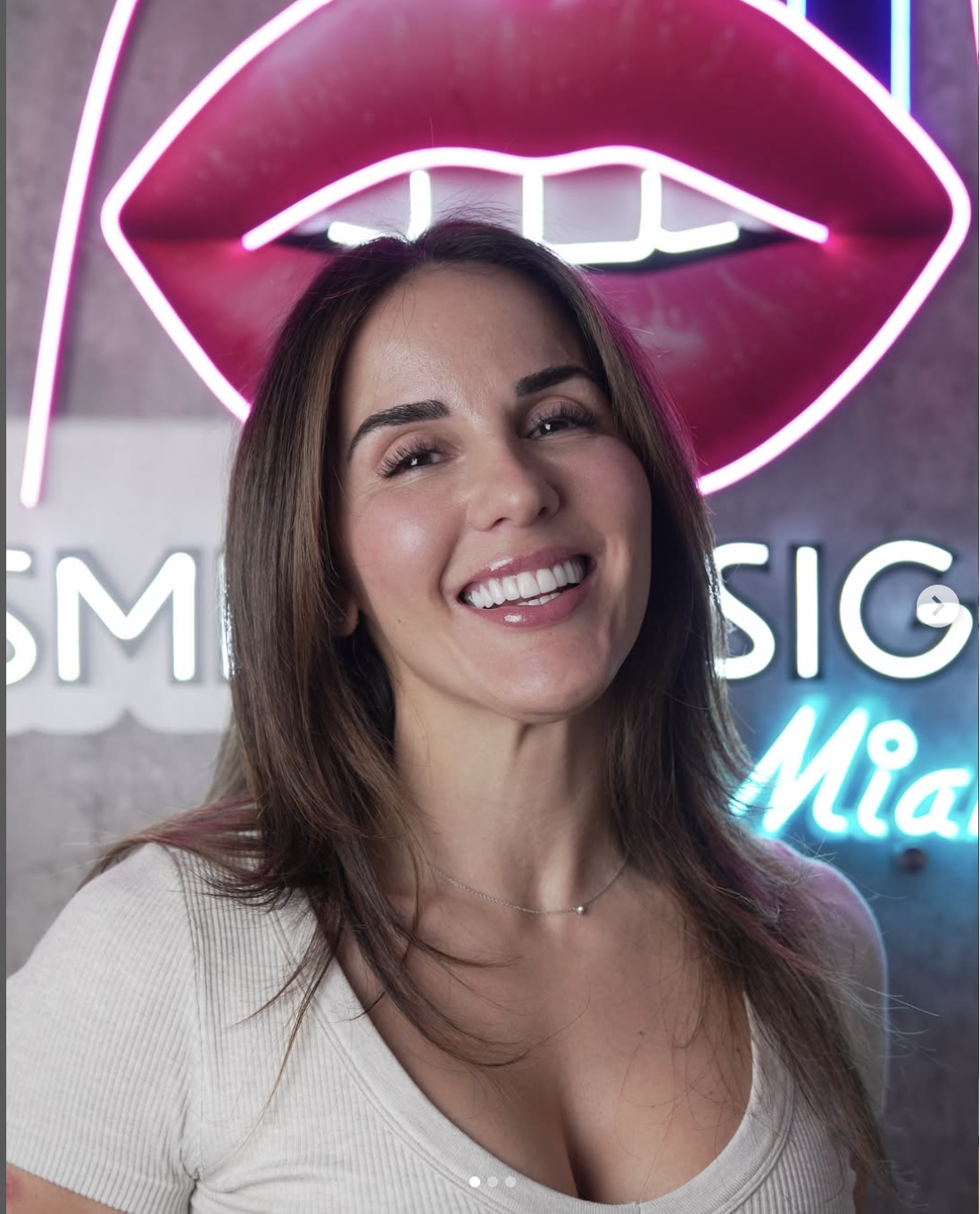 Veneers vs Crowns