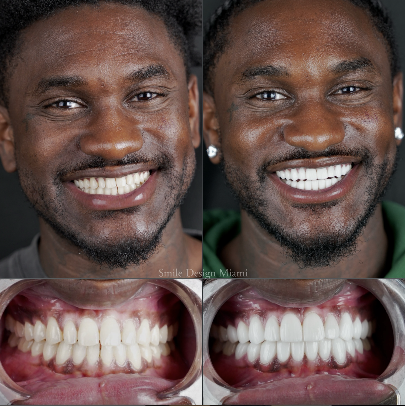 Maintain Your Smile